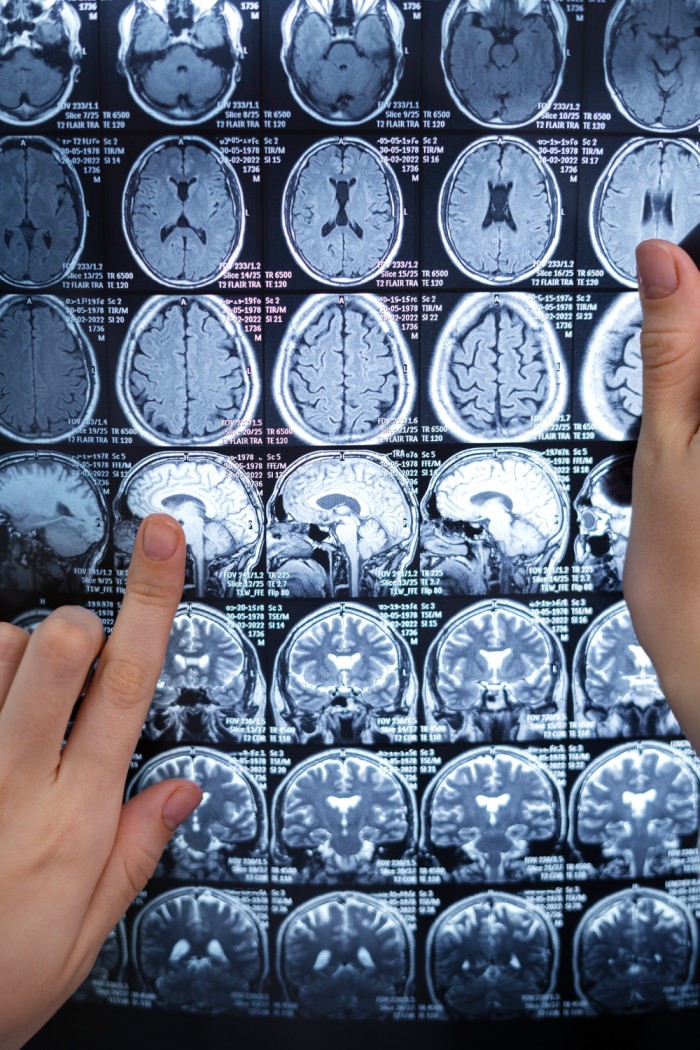 Neuro surgery